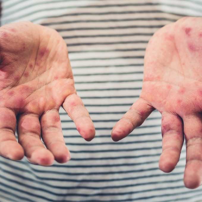 Ohio Biohazard & Trauma Cleanup Services Ohio Biohazard & Trauma Cleanup Services